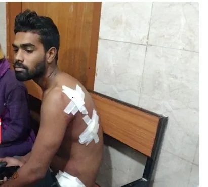 उधारी के रुपए मांगने पर हुआ विवाद ,युवक पर चाकु से किया हमला Oh My GodB No.1